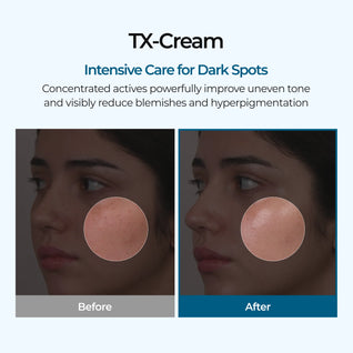 [Dr.Melaxin] TX Cream 50ml｜Nano-Sized Tranexamic Acid For Dark Spots & Hyperpigmentation