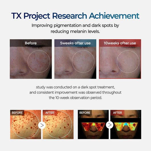 [Dr.Melaxin] TX Cream 50ml｜Nano-Sized Tranexamic Acid For Dark Spots & Hyperpigmentation